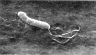 Electron micrographs of Helicobacter pylori