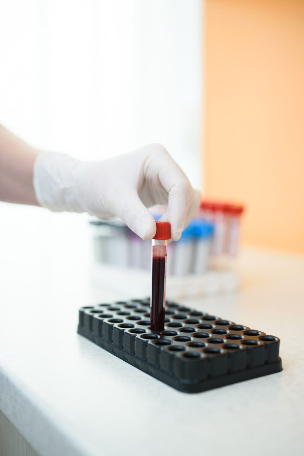 Vérminta előkészítése az Endomedix laboratóriumában